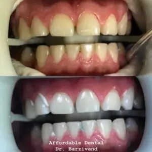 dentists-in-los-angeles affordable-dental