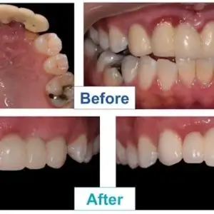 dentists-in-los-angeles-dr-merchant-dds-emergency-dentistry-and-oral-surgery