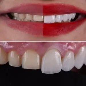 gentle-care-dentist-los-angeles