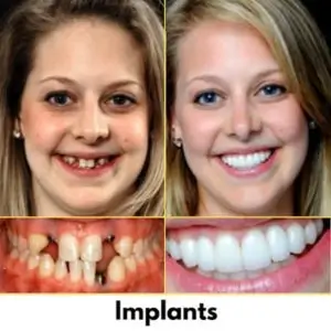 gentle-care-dentists-los-angeles