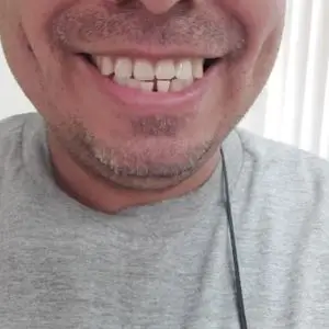 gentlecare-dentistry-los-angeles
