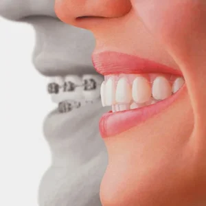 forever-dentistal-los-angeles