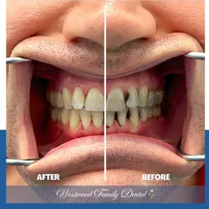 westwood-family-dental-clinic-los-angeles
